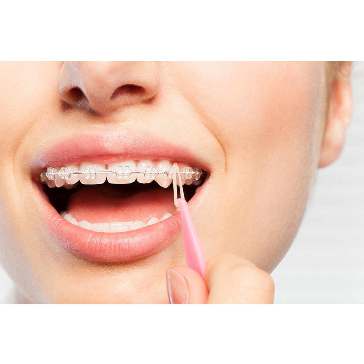 TP Ortho Plain Latex Tooth Colour Elastics White 1/8" - 2 Oz (Short Expiry 03-2026)