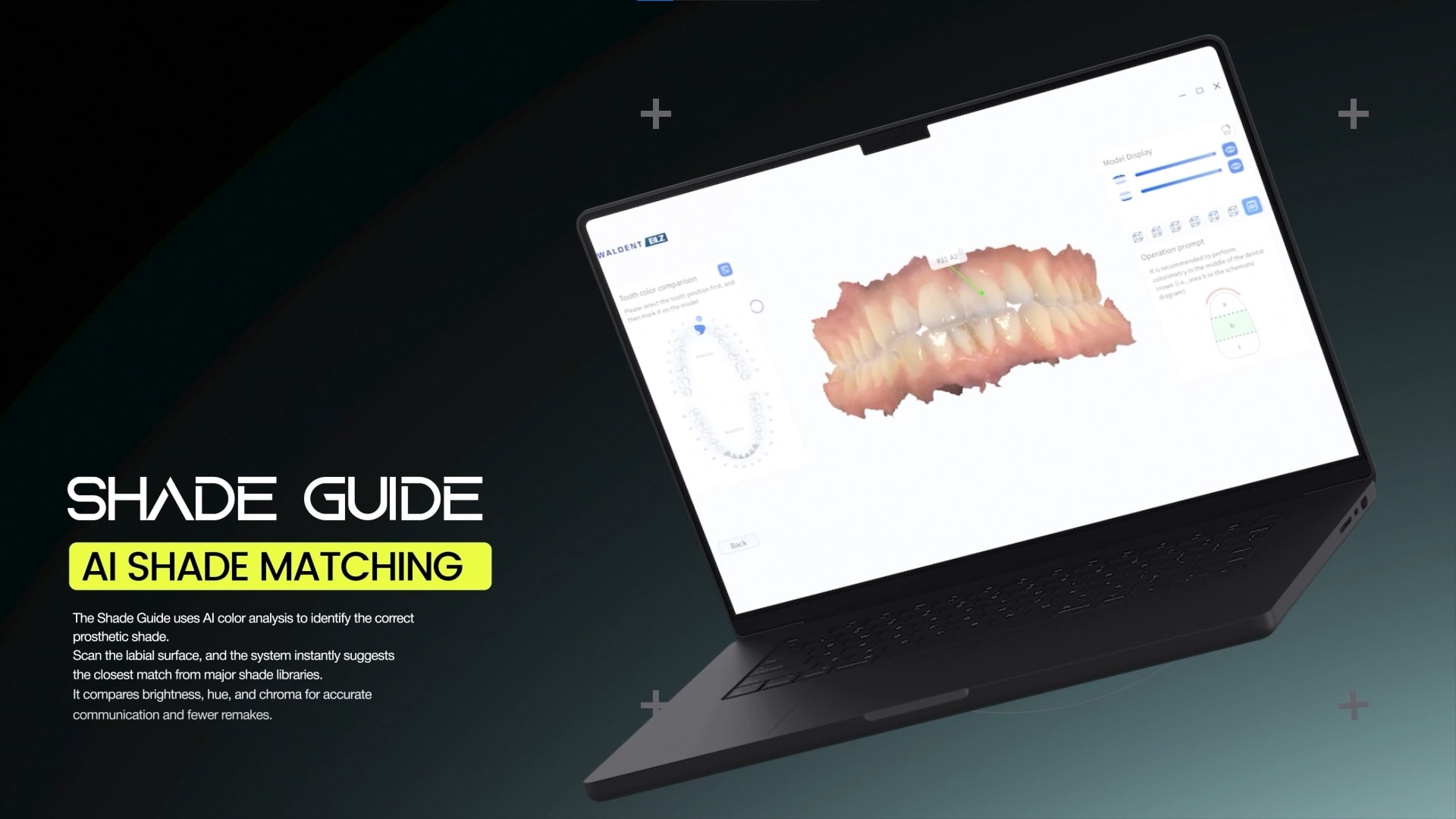 Waldent BLZ IntraVue 900 Ai Intraoral Scanner | Call +91-9311803455 For Easy Finance Options