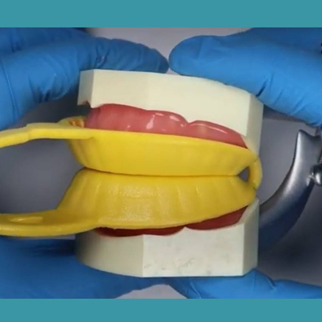 Vishal Dentocare Fluorovil Gel -Strawberry