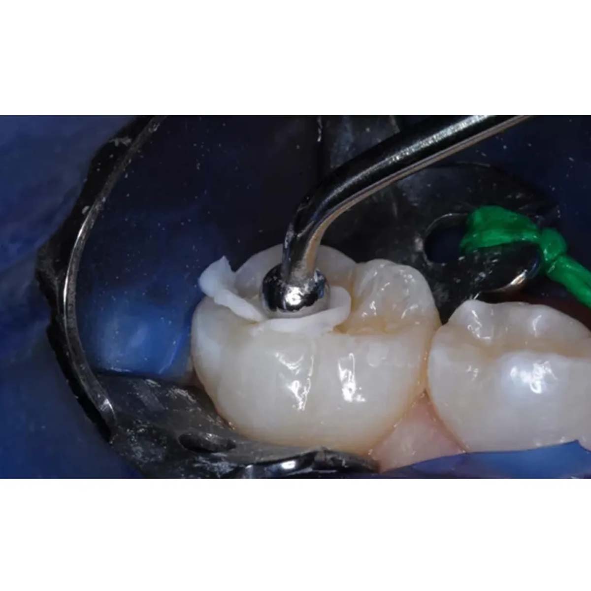 Oracraft Ball Burnisher #3 -BB22/23