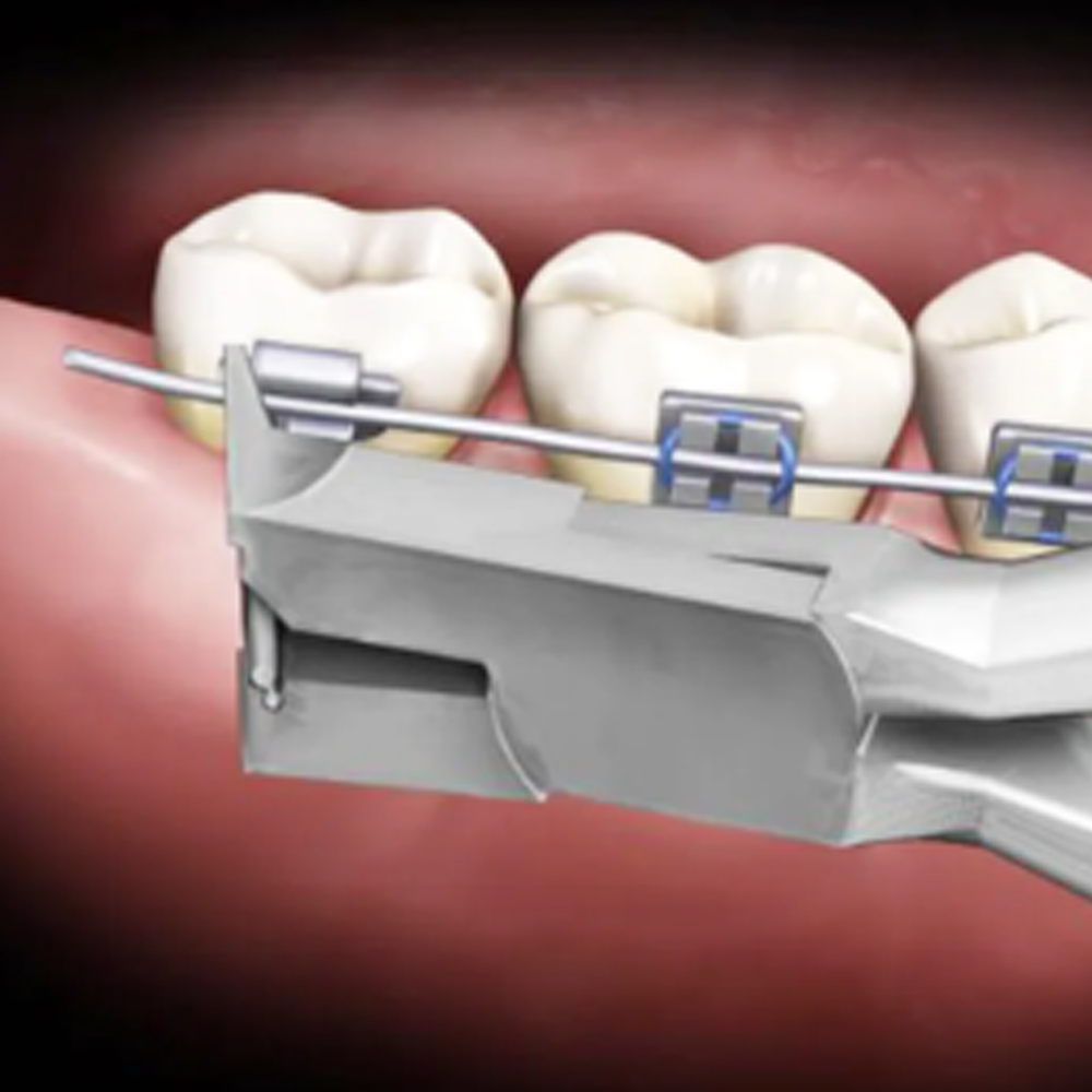 Koden Distal End Cutter (Euphoria League)