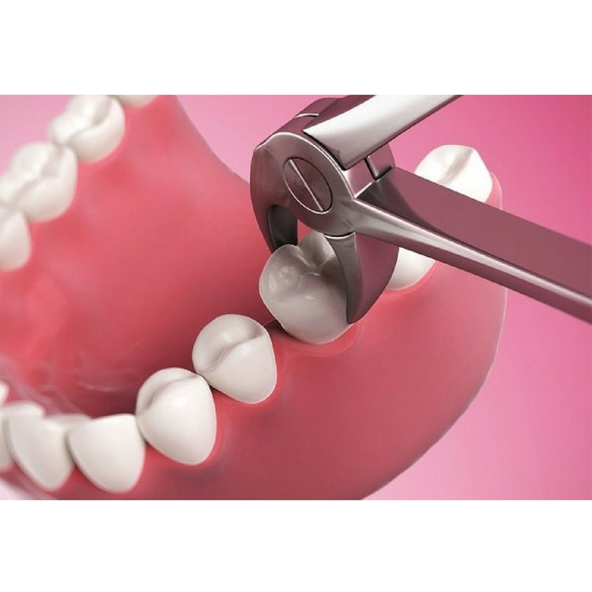 Waldent Tooth Extraction Forceps Lower Molars No.22 (1/122)