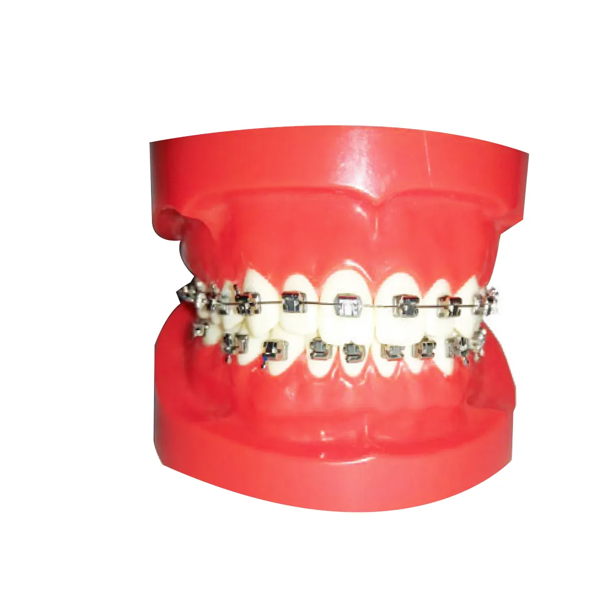 JJ Ortho Orthodontic Model With Selfy Passive Metal