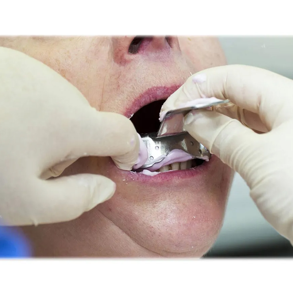 Oracraft Impression Tray Dentulous Perforated Kit Set of 8 - ITRLDPP8