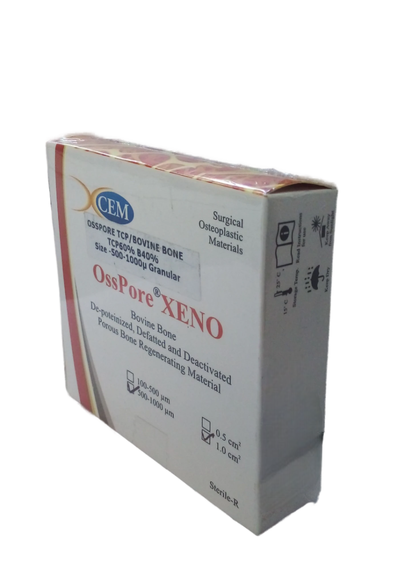 Xcem Osspore Bovine Bone / TCP Mix Grafts