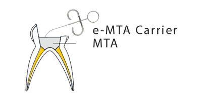 Kids-e-Dental E-MTA (Mineral Trioxide Aggregate)