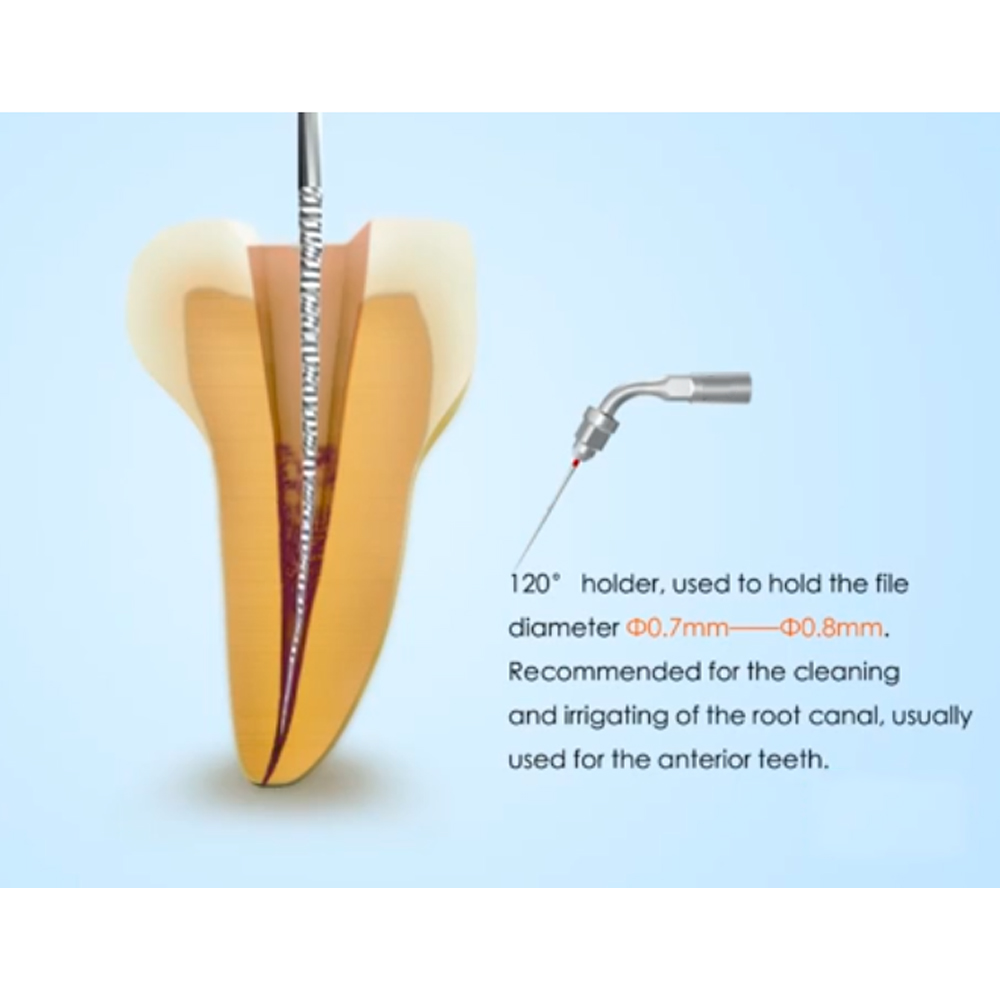 Woodpecker Scaler Tip ED1 for DTE & Satelec Scalers