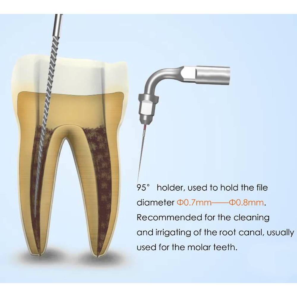 Woodpecker Scaler Tip ED2 for DTE & Satelec Scalers