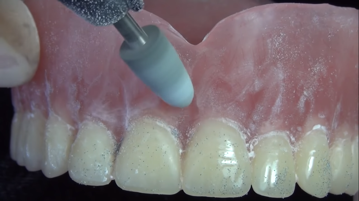 ET Dental Acrylic Polishers Round (Pack of 1)