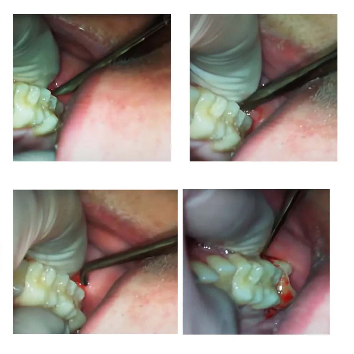 Oracraft Warwick James Elevators Set of 3 - EWJS3