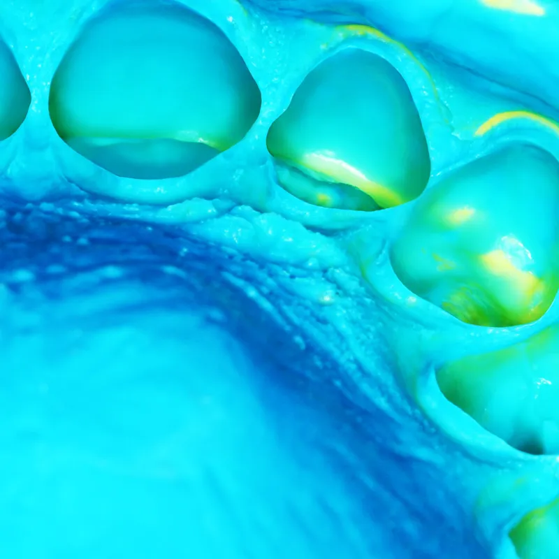 Zhermack Elite Hd+ Soft Putty Normal Set 4 x 450ML