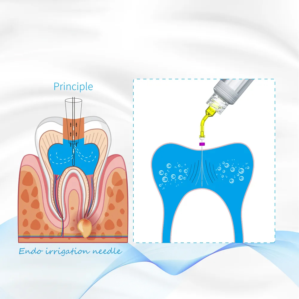 Younique Youni Endo 360