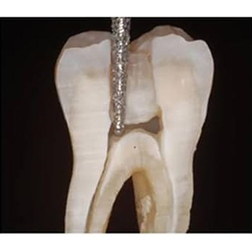 SuperEndo Endo Access Bur - 14