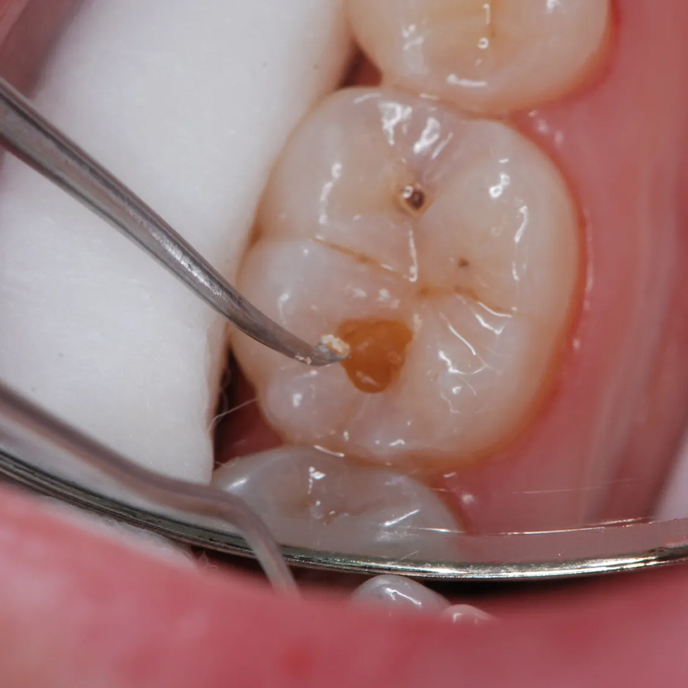 Oracraft Spoon Excavator #3 - EXC18H