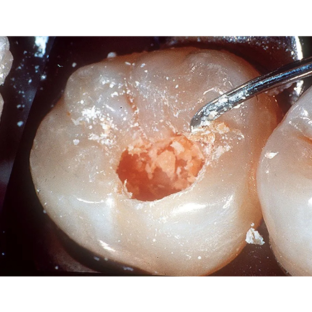 GDC Spoon Excavator - 1 (Exc817)