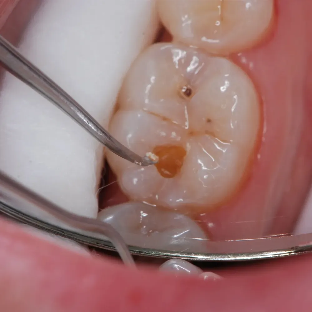 Api+ Excavator Hollow 