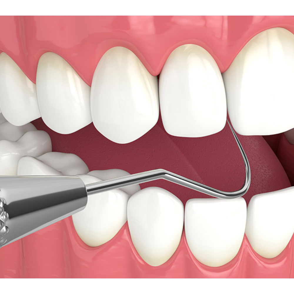 GDC Single End Explorer -1 (Exs8)