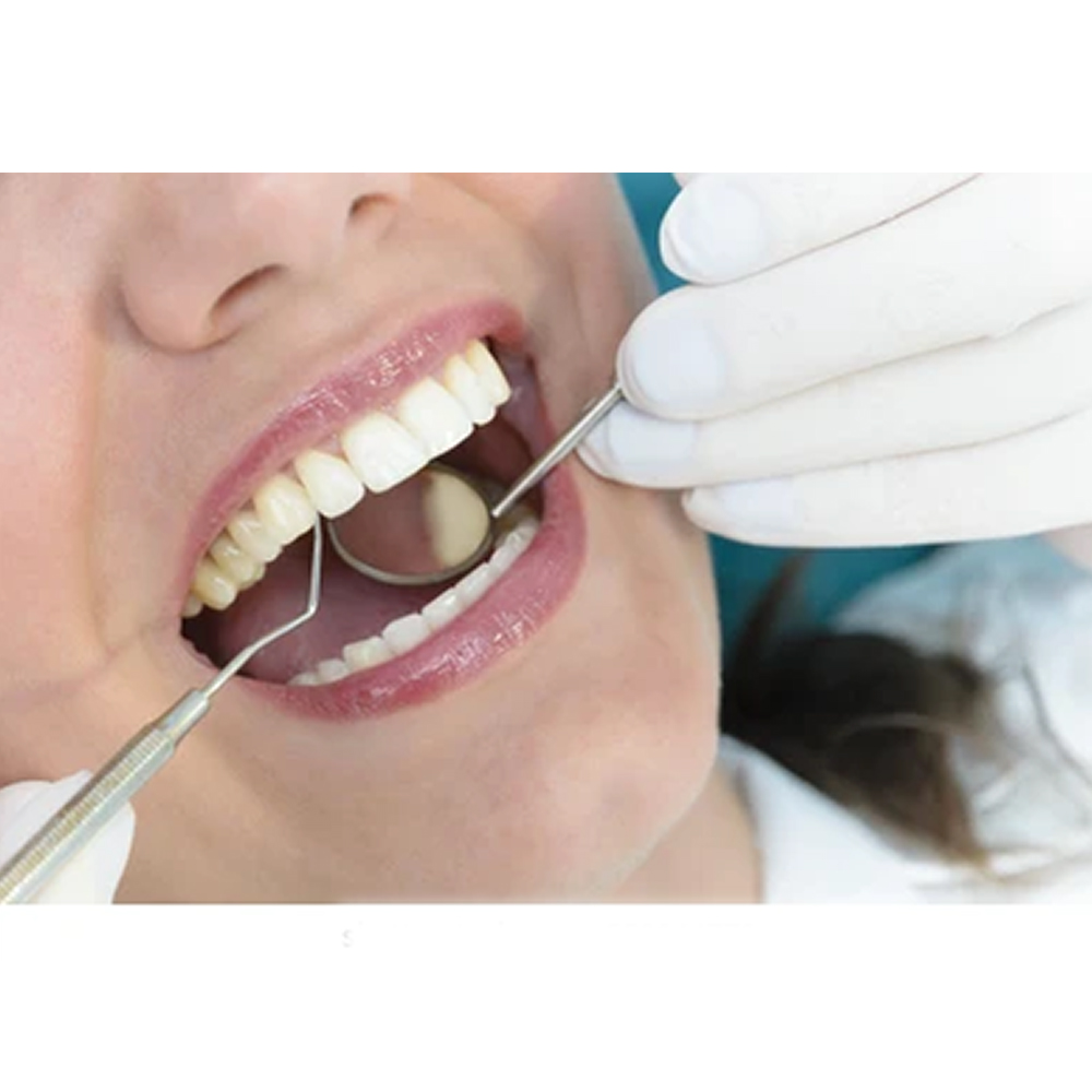 GDC Single End Probe #3 (EXS55)