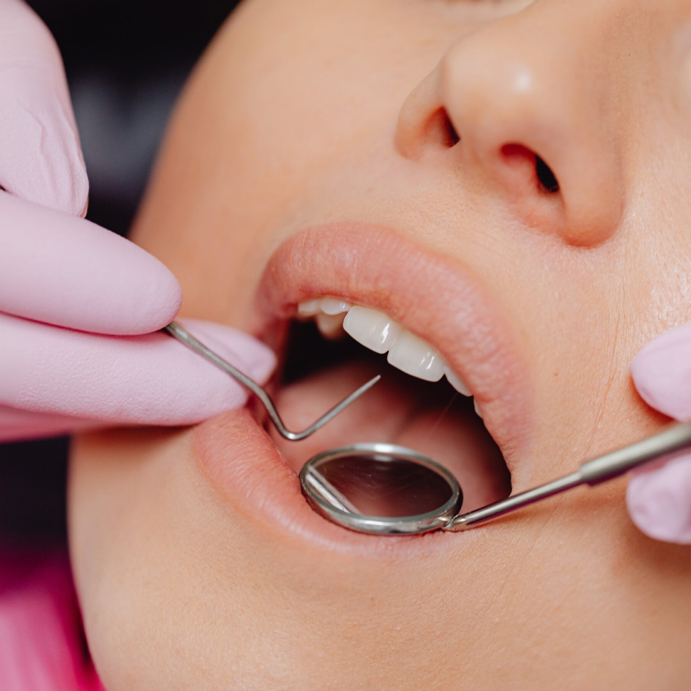 GDC Single End Probe -1 (Exs9)