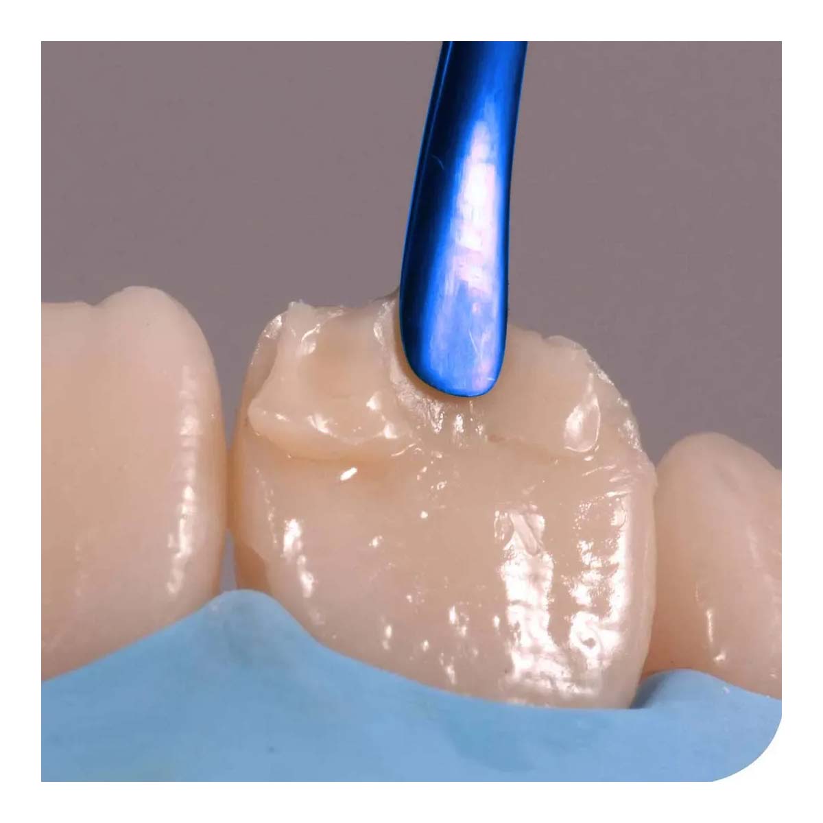 Oracraft Titanium Coated Composite Instruments