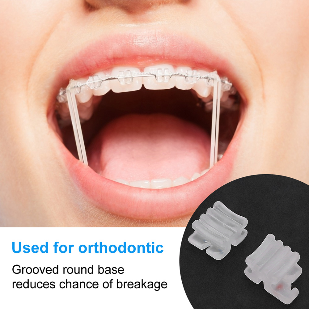 Ceramic Bracket Kits