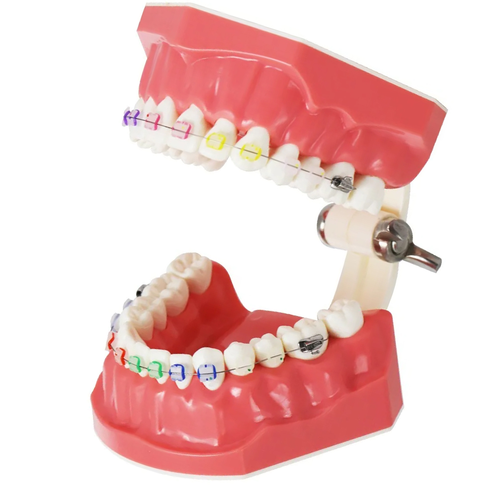 Identical Orthodontic Patient Education Model (Ceramic) - M3002