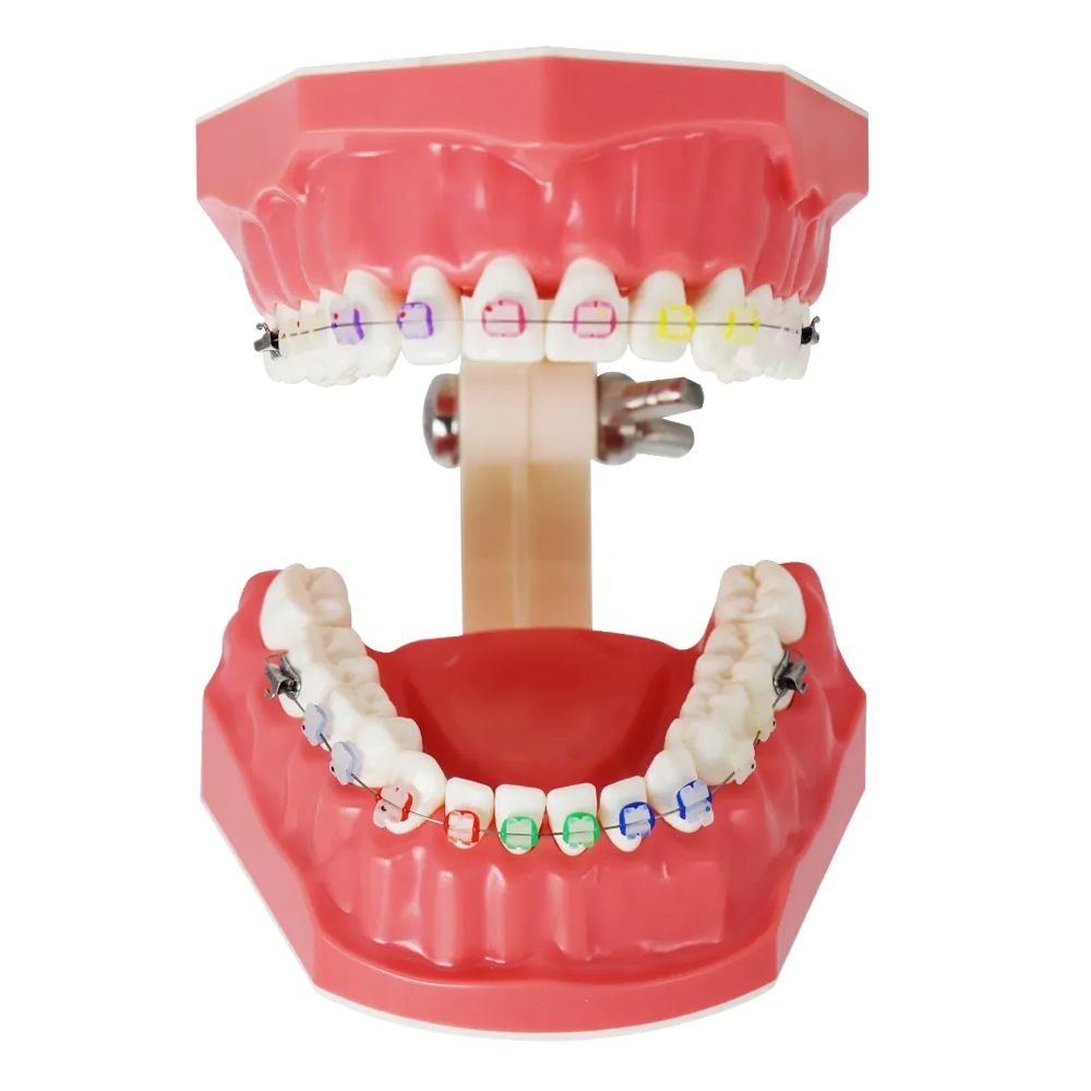 Identical Orthodontic Patient Education Model (Ceramic) - M3002	