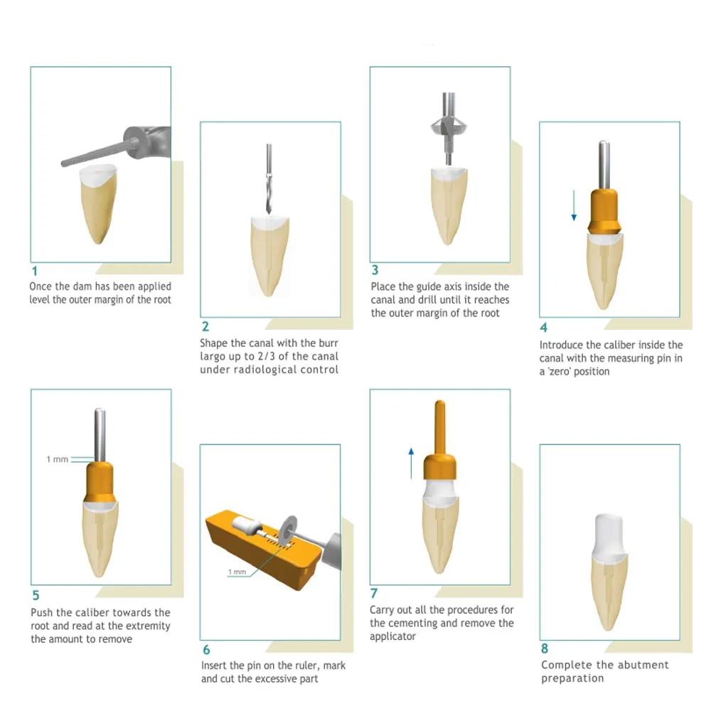 Younique Fiber Site Post Refills (Pack of 10pcs) 