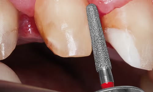 Mani Diamond Airotor Burs CE Series