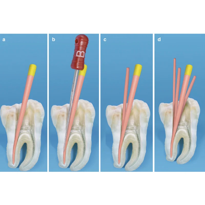 Mani Flare Finger Spreader 21mm