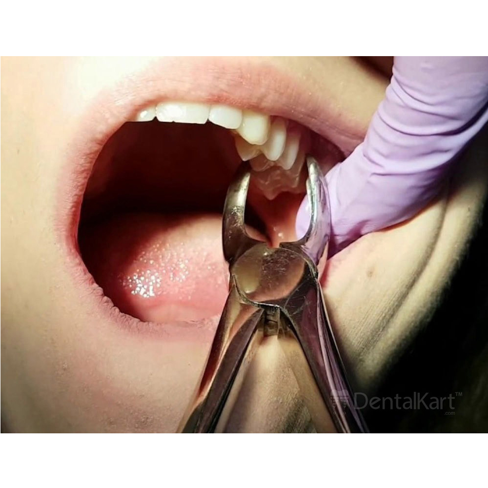 GDC Extraction Forceps Upper Molar Left Ergonomic (FX18E)