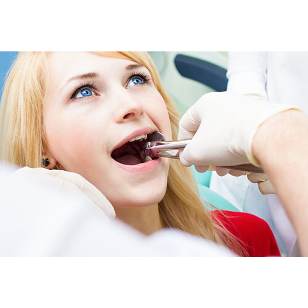 GDC Extraction Forceps Lower Roots - 33 Premium (FX33P)