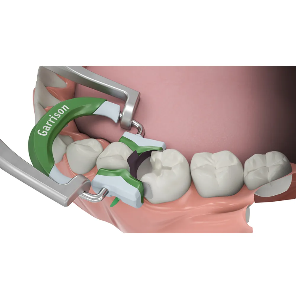 Garrison Reel Matrix Dental Kit RMK05 Dentistry Operative for Composite or  Amal for sale online