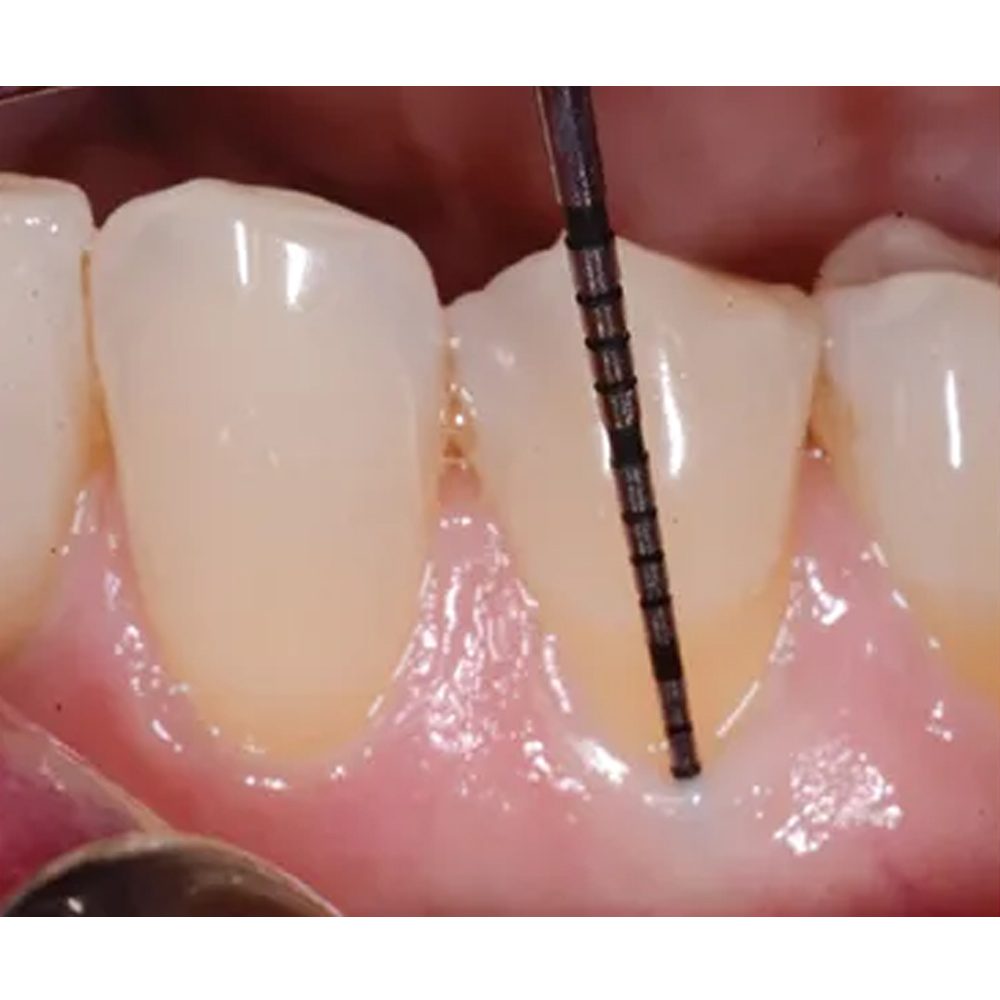 GDC University of North Carolina/William Premium - 6 (PCPUNC15/W6)