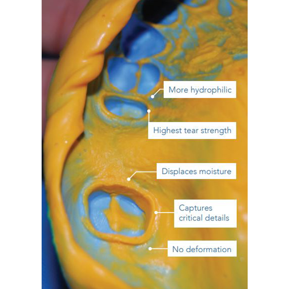 GC Flexceed Putty And Kit