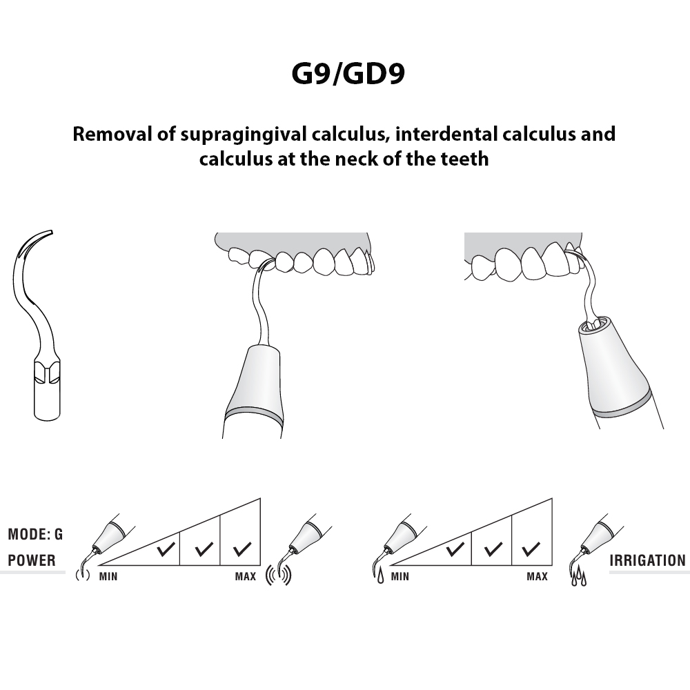 Woodpecker Scaler Tip GD9 for DTE & Satelec Scalers