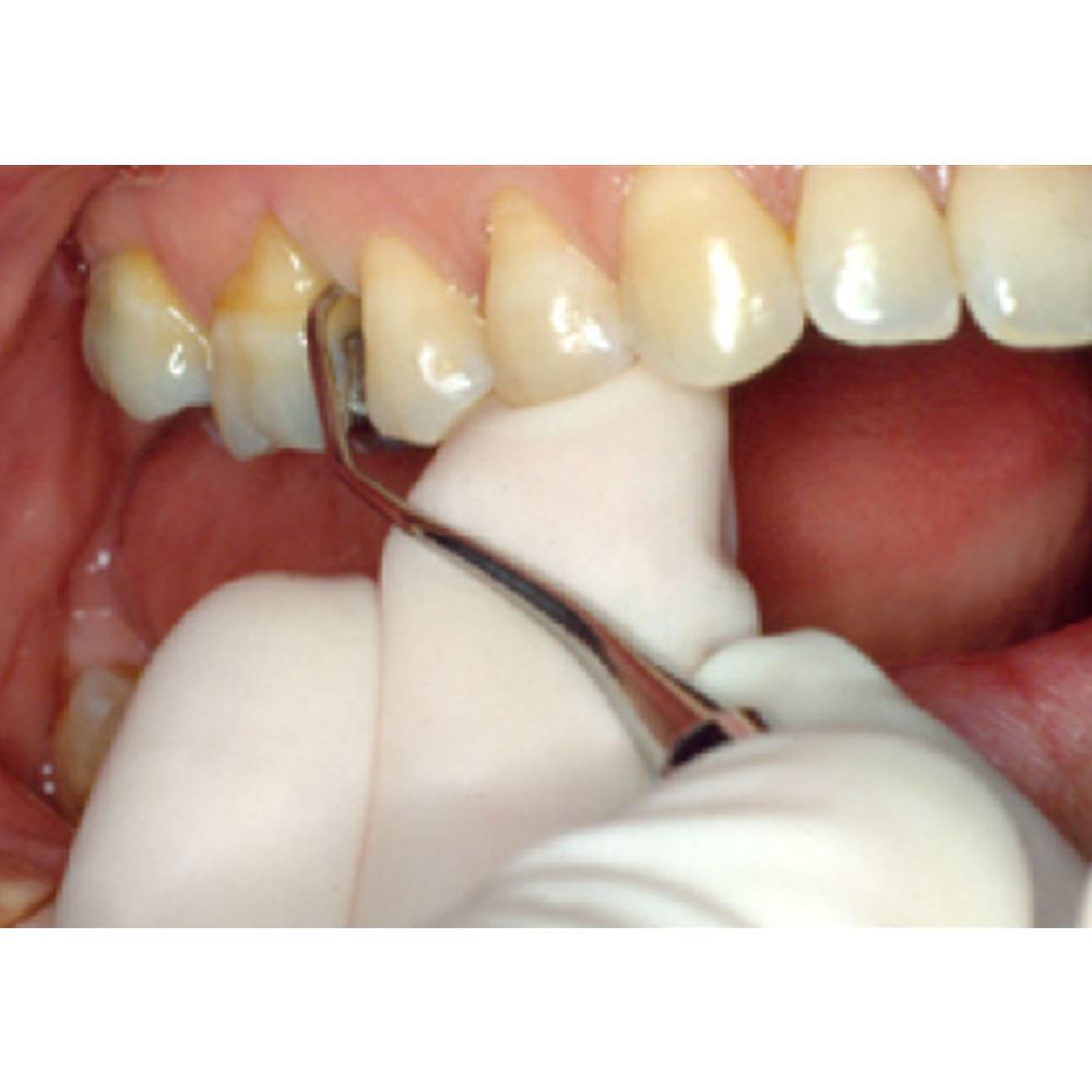 GDC Gracey Curettes #3 (Sg11/12)