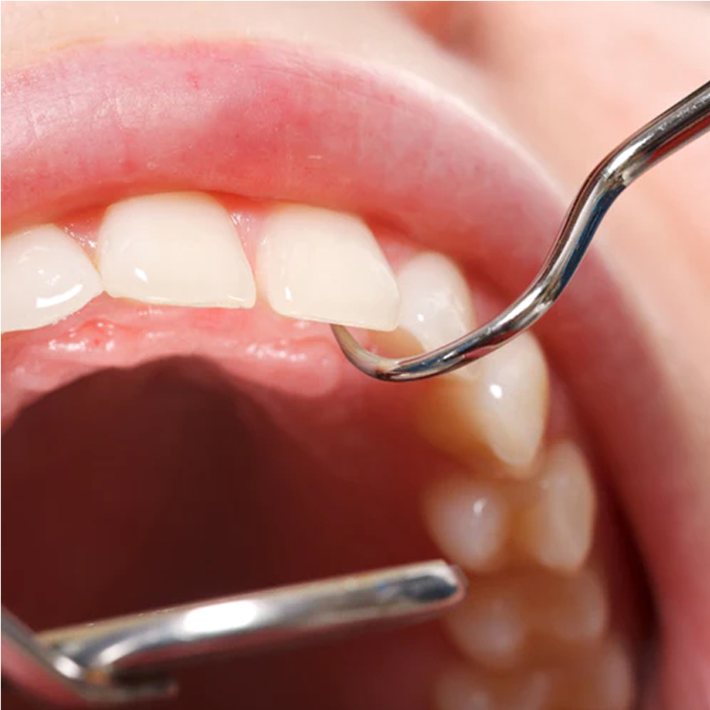 Waldent PMT Set Instrument Kit (Double Ended) (K13/2) 