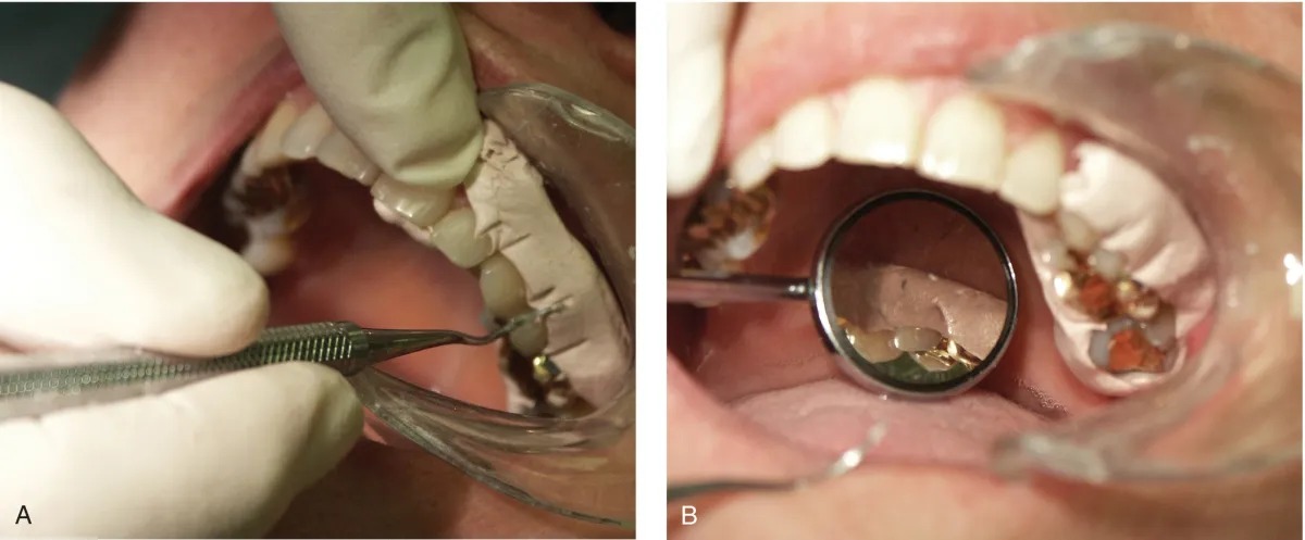 Vishal Dentocare Peripack