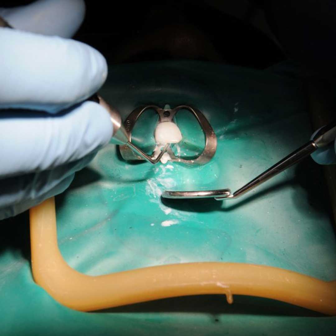 Waldent Rubber Dam Clamps Kit Titanium Gold (Set of 11) (K16/3)