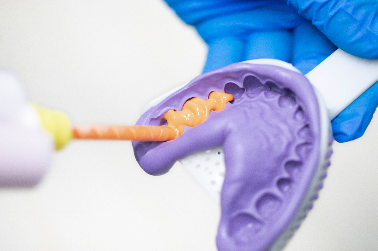 Waldent Flexident A-Silicone Soft Putty kit       