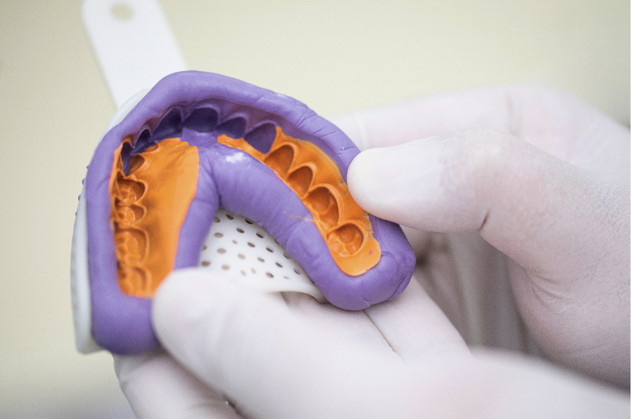 Waldent Flexident A-Silicone Soft Putty kit       