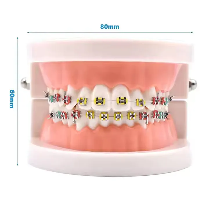 Patient Education Model With Orthodontic Brackets MD-119