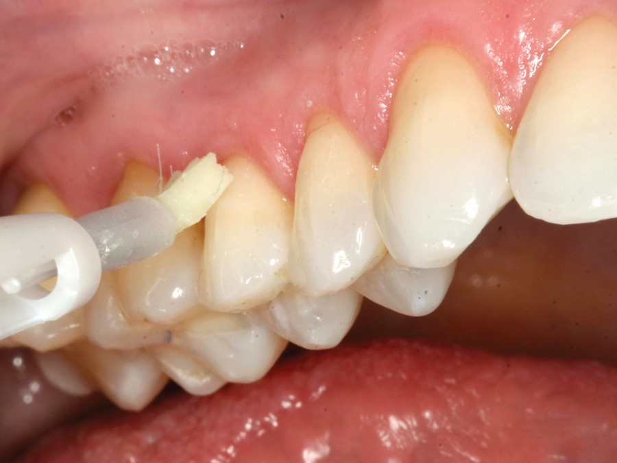 Revolutionize Restoration with Nano Coat