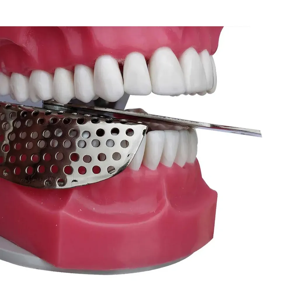 GDC Impression Trays Half Right 1 (Itrldphr1) Online at Best Price