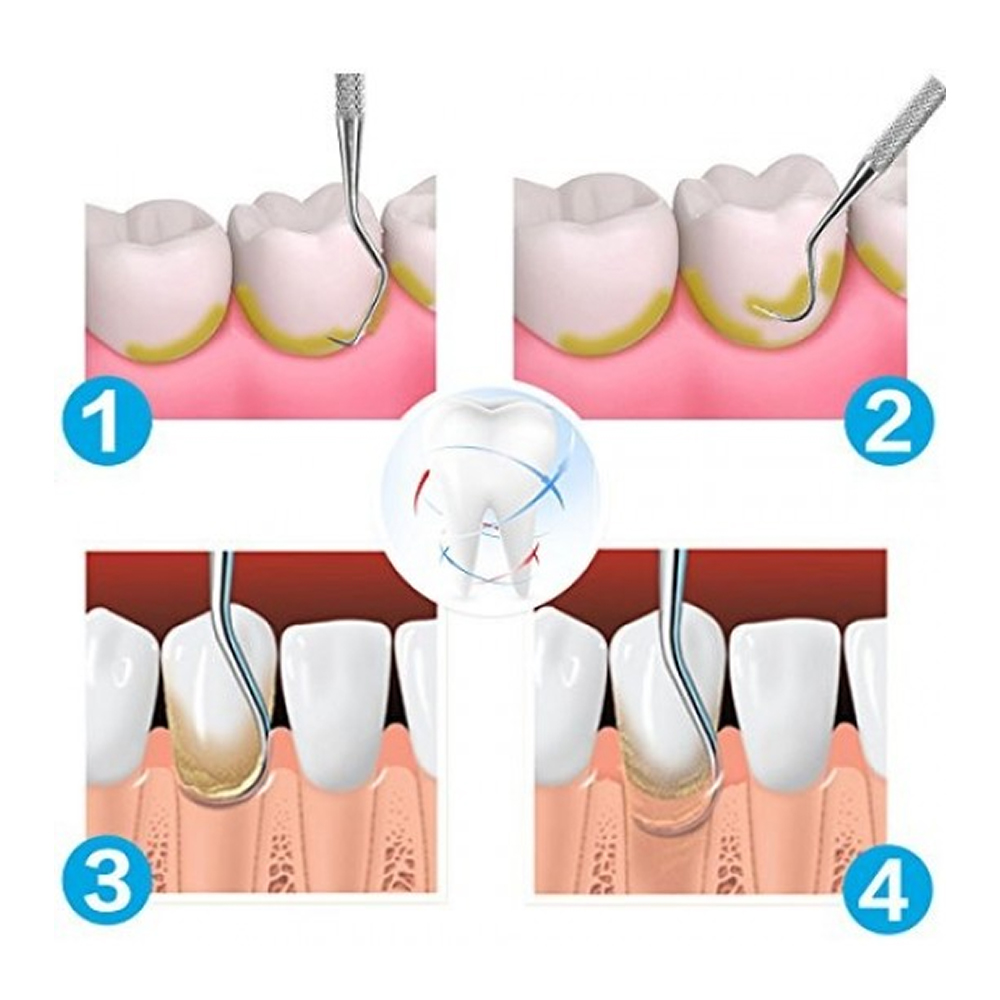 Oracraft Perio Scalers Set Of 8 - PSP8