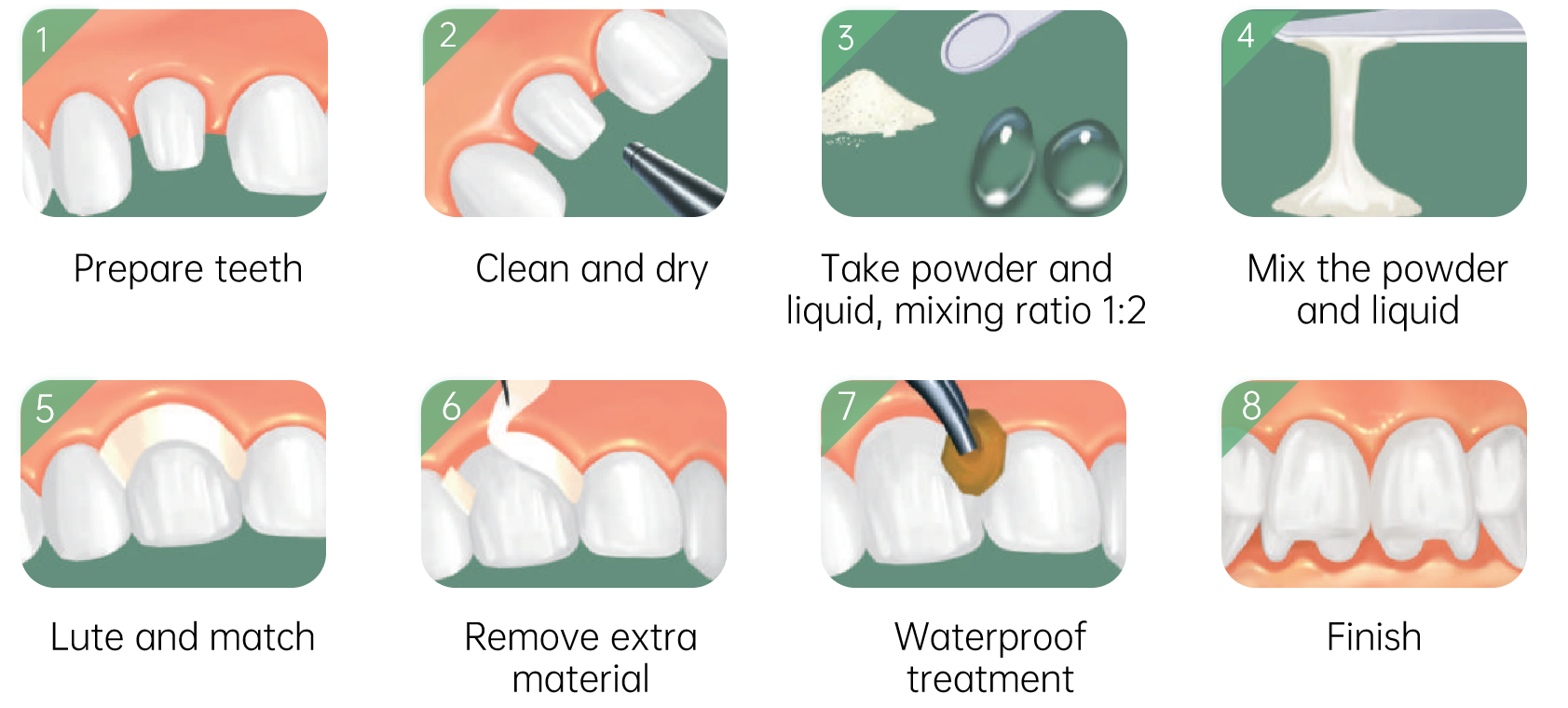 Prevest Crysta GIC Luting I