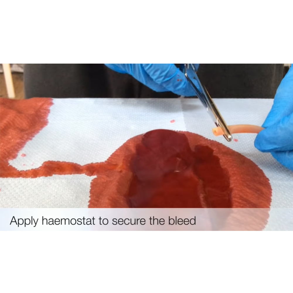 GDC Hemostats (Artery Forceps)