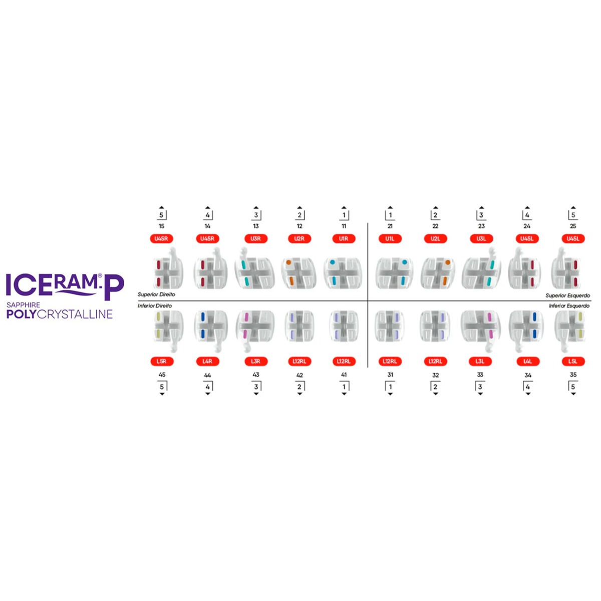 OrthoMetric Iceram - P Polycrystalline Ceramic Bracket Kit