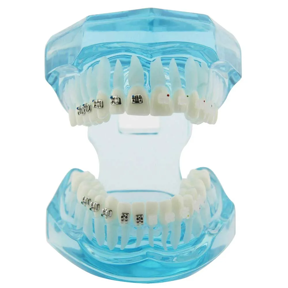 iDENTical Half Metal and Half Ceramic Brackets Orthodontics Model